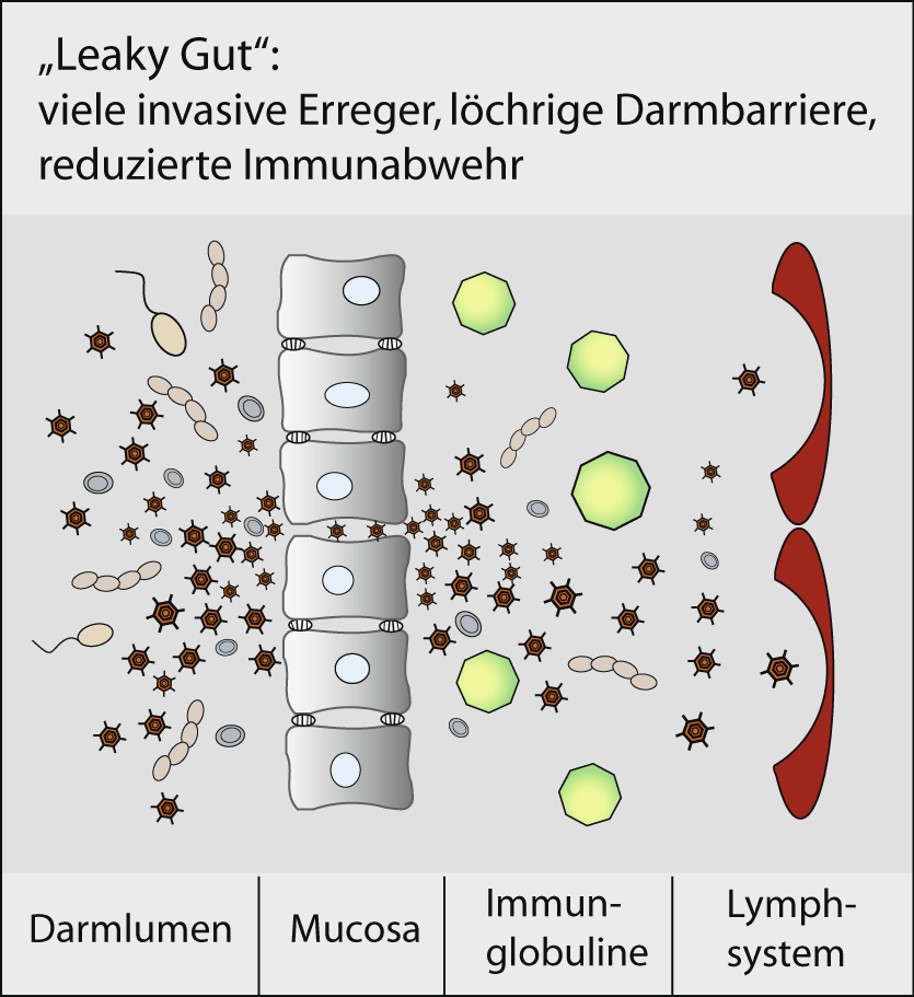 "Leaky Gut"-Zustand "Leaky Gut"-Zustand