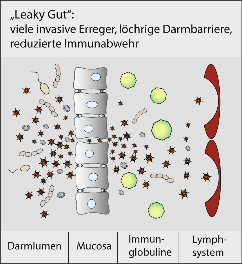"Leaky Gut"-Zustand